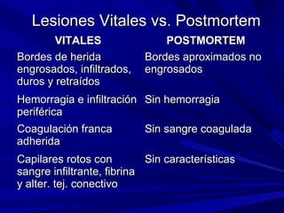 Lesiones VViittaalleess vvss.. PPoossttmmoorrtteemm 
VVIITTAALLEESS PPOOSSTTMMOORRTTEEMM 
BBoorrddeess ddee hheerriiddaa 
eennggrroossaaddooss,, iinnffiillttrraaddooss,, 
dduurrooss yy rreettrraaííddooss 
BBoorrddeess aapprrooxxiimmaaddooss nnoo 
eennggrroossaaddooss 
HHeemmoorrrraaggiiaa ee iinnffiillttrraacciióónn 
ppeerriifféérriiccaa 
SSiinn hheemmoorrrraaggiiaa 
CCooaagguullaacciióónn ffrraannccaa 
aaddhheerriiddaa 
SSiinn ssaannggrree ccooaagguullaaddaa 
CCaappiillaarreess rroottooss ccoonn 
ssaannggrree iinnffiillttrraannttee,, ffiibbrriinnaa 
yy aalltteerr.. tteejj.. ccoonneeccttiivvoo 
SSiinn ccaarraacctteerrííssttiiccaass 
 