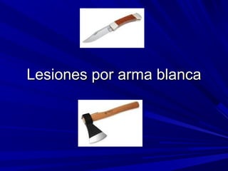 LLeessiioonneess ppoorr aarrmmaa bbllaannccaa 
 