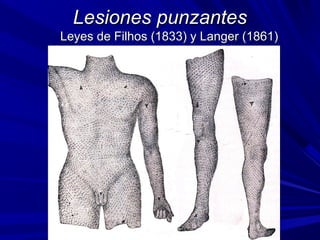 LLeessiioonneess ppuunnzzaanntteess 
LLeeyyeess ddee FFiillhhooss ((11883333)) yy LLaannggeerr ((11886611)) 
 