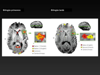 Bilingüe primerenc Bilingüe tardà 