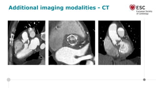 Additional imaging modalities - CT
 