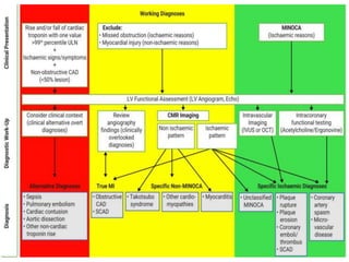 Esc Acs Algorithm Esc 2020 guidelines for the management of acute coronary | PPTX