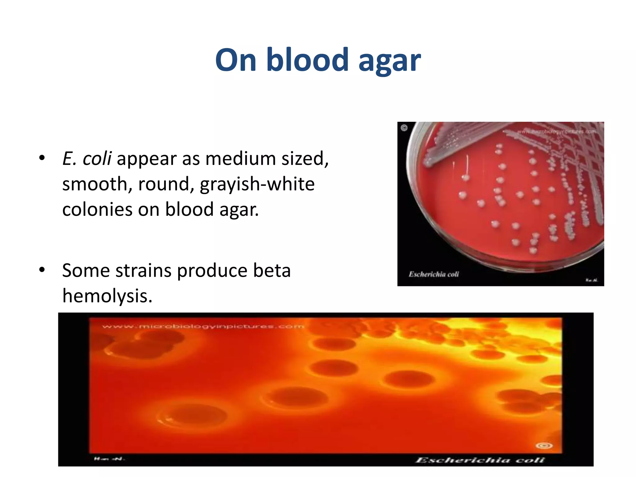 On blood agar
• E. coli appear as medium sized,
smooth, round, grayish-white
colonies on blood agar.
• Some strains produce beta
hemolysis.