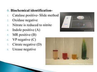 6. Biochemical identification-
1. Catalase positive- Slide method
2. Oxidase negative
3. Nitrate is reduced to nitrite
4. Indole positive (A)
5. MR positive (B)
6. VP negative (C)
7. Citrate negative (D)
8. Urease negative
 
