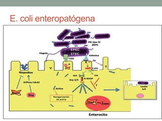 E. coli enteropatógena
 