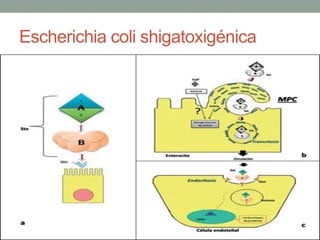 Escherichia coli shigatoxigénica
 