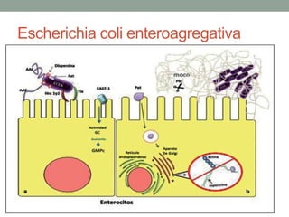 Escherichia coli enteroagregativa
 