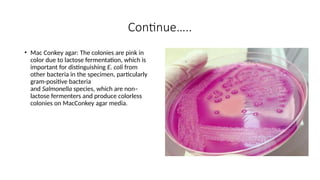 Colorless Colonies Escherichia coli pptx with its morphology | PPTX