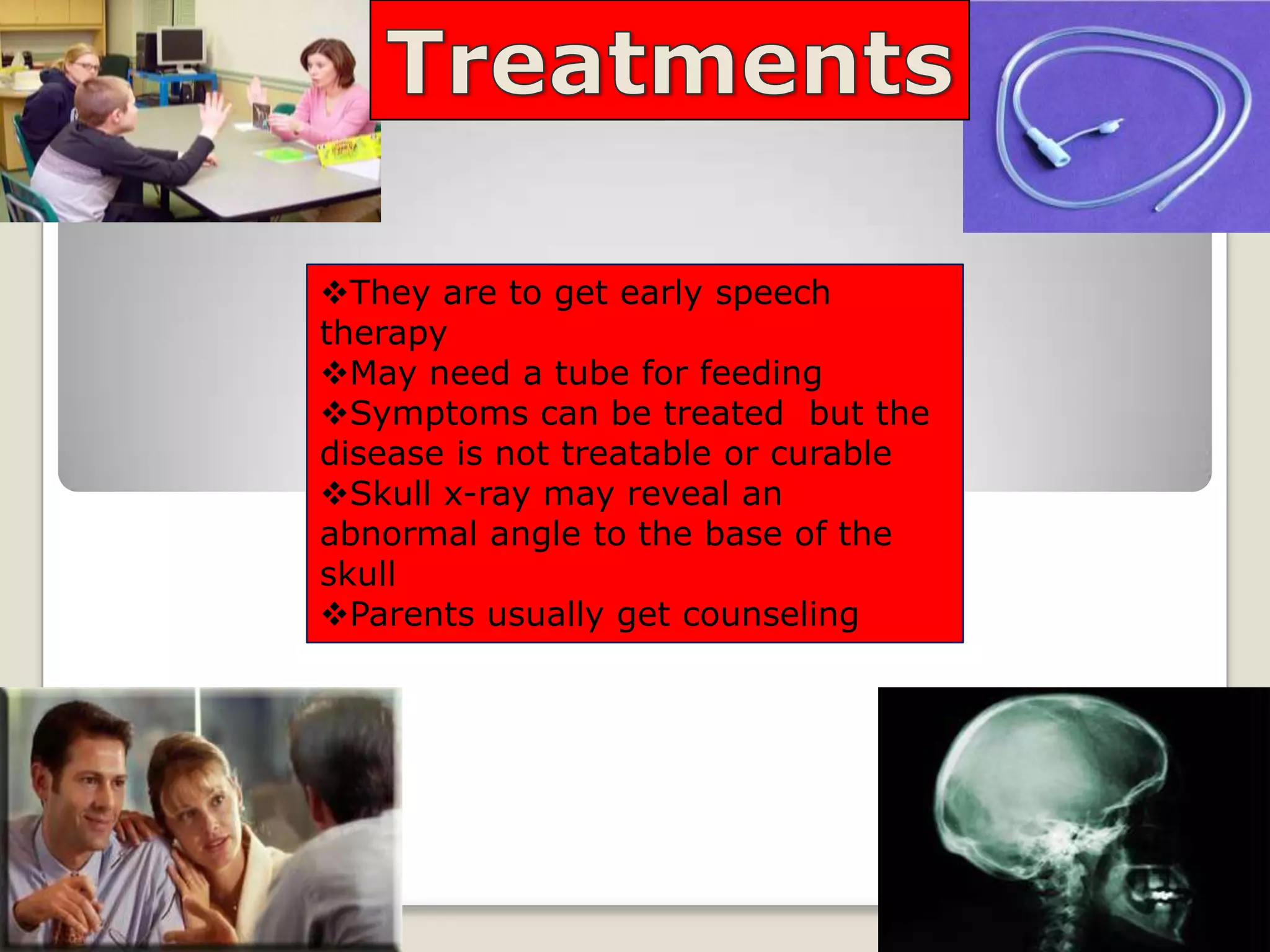 Cri Du Chat Syndrome