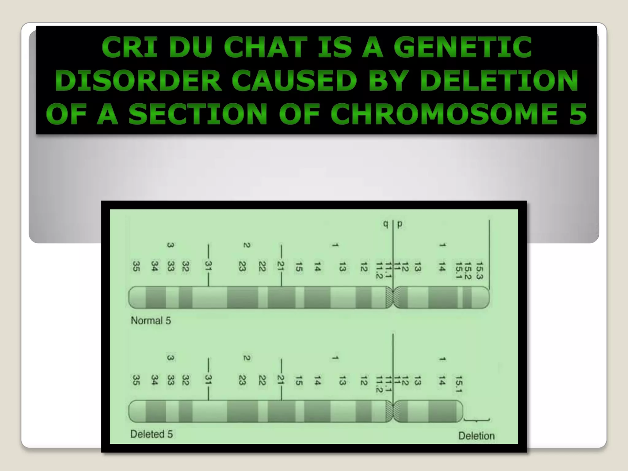 Cri Du Chat Syndrome