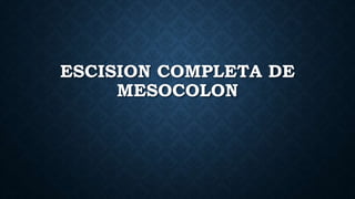 ESCISION COMPLETA DE
MESOCOLON
 