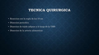 TECNICA QUIRURGICA
• Reseccion con la regla de los 10 cm
• Diseccion pericolica
• Diseccion de tejido adiposo a lo largo de la VMS
• Diseccion de la arteria alimenticia
 