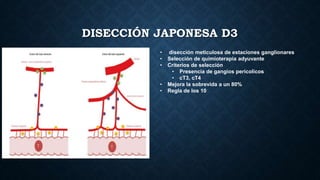 DISECCIÓN JAPONESA D3
• disección meticulosa de estaciones ganglionares
• Selección de quimioterapia adyuvante
• Criterios de selección
• Presencia de gangios pericolicos
• cT3, cT4
• Mejora la sobrevida a un 80%
• Regla de los 10
 