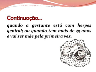 quando a gestante está com herpes genital; ou quando tem mais de 35 anos e vai ser mãe pela primeira vez.  
