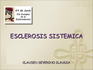 ESCLEROSIS SISTEMICA



   CLAUSEN SEVERINO CLAUDIA
 