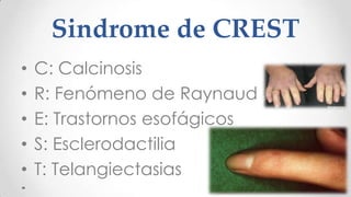 Sindrome de CREST
•   C: Calcinosis
•   R: Fenómeno de Raynaud
•   E: Trastornos esofágicos
•   S: Esclerodactilia
•   T: Telangiectasias
 