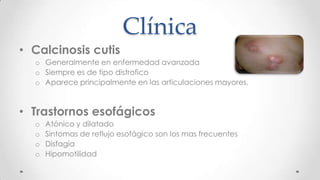 Clínica
• Calcinosis cutis
  o Generalmente en enfermedad avanzada
  o Siempre es de tipo distrofico
  o Aparece principalmente en las articulaciones mayores.



• Trastornos esofágicos
  o   Atónico y dilatado
  o   Sintomas de reflujo esofágico son los mas frecuentes
  o   Disfagia
  o   Hipomotilidad
 