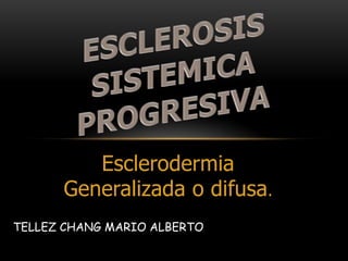 Esclerodermia
      Generalizada o difusa.
TELLEZ CHANG MARIO ALBERTO
 