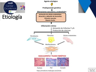 Etiología
https://emedicine.medscape.com/article
Agente etiológico
Predisposición genética
Alteraciones vasculares y endoteliales
Activación de células endoteliales.
Atracción y adhesión de leucocitos.
Oclusión vascular.
Hipoxia tisular.
Inflamación crónica
Activación de linfocitos T y B.
Producción de citocinas
Fibroblastos Fibrocitos Células endoteliales
Miofibroblastos
VASCULOPATÍA Y TEJIDO FIBRÓTICO
Pulmón Piel Corazón
Dra. De Lira
CRAIC Mty
 