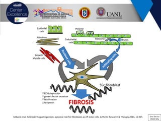 Gilbane et al. Scleroderma pathogenesis: a pivotal role for fibroblasts as eff ector cells. Arthritis Research & Therapy 2013, 15:215 Dra. De Lira
CRAIC Mty
 