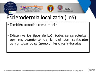Esclerodermia localizada (LoS)
• También conocida como morfea.
• Existen varios tipos de LoS, todos se caracterizan
por engrosamiento de la piel con cantidades
aumentadas de colágeno en lesiones induradas.
M Figueiroa-Careta, R Romiti. Localized scleroderma: clinical spectrum and therapeutic update. An Bras Dermatol. 2015;90(1):62-73.
Dra. De Lira
CRAIC Mty
 