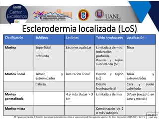 M Figueiroa-Careta, R Romiti. Localized scleroderma: clinical spectrum and therapeutic update. An Bras Dermatol. 2015;90(1):62-73.
Esclerodermia localizada (LoS)
Clasificación Subtipos Lesiones Tejido involucrado Localización
Morfea Superficial
Profundo
Lesiones ovaladas Limitada a dermis
Induración
profunda
Dermis y tejido
subcutáneo (SC)
Tórax
Morfea lineal Tronco y
extremidades
Induración lineal Dermis y tejido
(sc)
Tórax y
extremidades
Cabeza Dermis
frontoparietal
Cara y cuero
cabelludo
Morfea
generalizada
4 o más placas > 3
cm
Limitado a dermis Difuso (excepto en
cara y manos)
Morfea mixta Combinación de 2
o más subtipos Dra. De Lira
CRAIC Mty
 