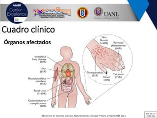 Cuadro clínico
Allanore et al. Systemic sclerosis. Nature Reviews, Disease Primers. 23 April 2015 Vol 1
Órganos afectados
Dra. De Lira
CRAIC Mty
 