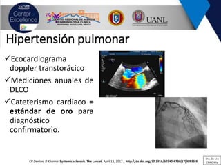Hipertensión pulmonar
✓Ecocardiograma
doppler transtorácico
✓Mediciones anuales de
DLCO
✓Cateterismo cardiaco =
estándar de oro para
diagnóstico
confirmatorio.
CP Denton, D Khanna Systemic sclerosis. The Lancet. April 13, 2017. http://dx.doi.org/10.1016/S0140-6736(17)30933-9
Dra. De Lira
CRAIC Mty
 