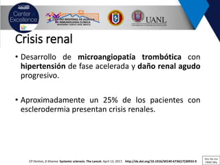 Crisis renal
• Desarrollo de microangiopatía trombótica con
hipertensión de fase acelerada y daño renal agudo
progresivo.
• Aproximadamente un 25% de los pacientes con
esclerodermia presentan crisis renales.
CP Denton, D Khanna Systemic sclerosis. The Lancet. April 13, 2017. http://dx.doi.org/10.1016/S0140-6736(17)30933-9
Dra. De Lira
CRAIC Mty
 
