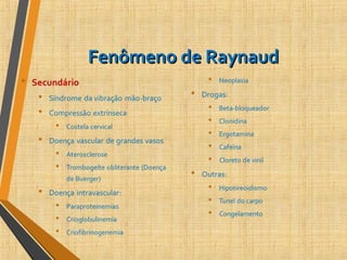 Fenômeno de RaynaudFenômeno de Raynaud
 