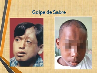 Golpe de SabreGolpe de Sabre
 