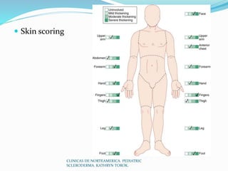 Scleroderma Activity Score Esclerodermia sistemica | PPTX