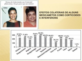EFEITOS COLATERAIS DE ALGUNS
MEDICAMETOS COMO CORTICOIDES
E INTERFERONS
 