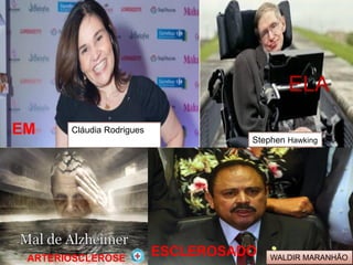 ELA
Stephen Hawking
Cláudia RodriguesEM
ESCLEROSADO WALDIR MARANHÃOARTERIOSCLEROSE
 