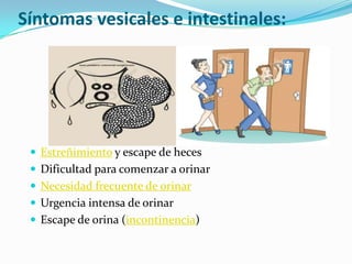 Síntomas vesicales e intestinales:
 Estreñimiento y escape de heces
 Dificultad para comenzar a orinar
 Necesidad frecuente de orinar
 Urgencia intensa de orinar
 Escape de orina (incontinencia)
 