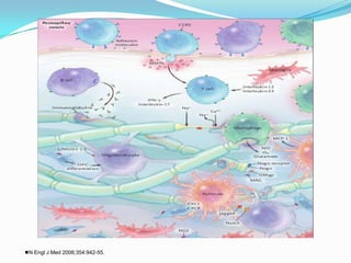N Engl J Med 2006;354:942-55.
 