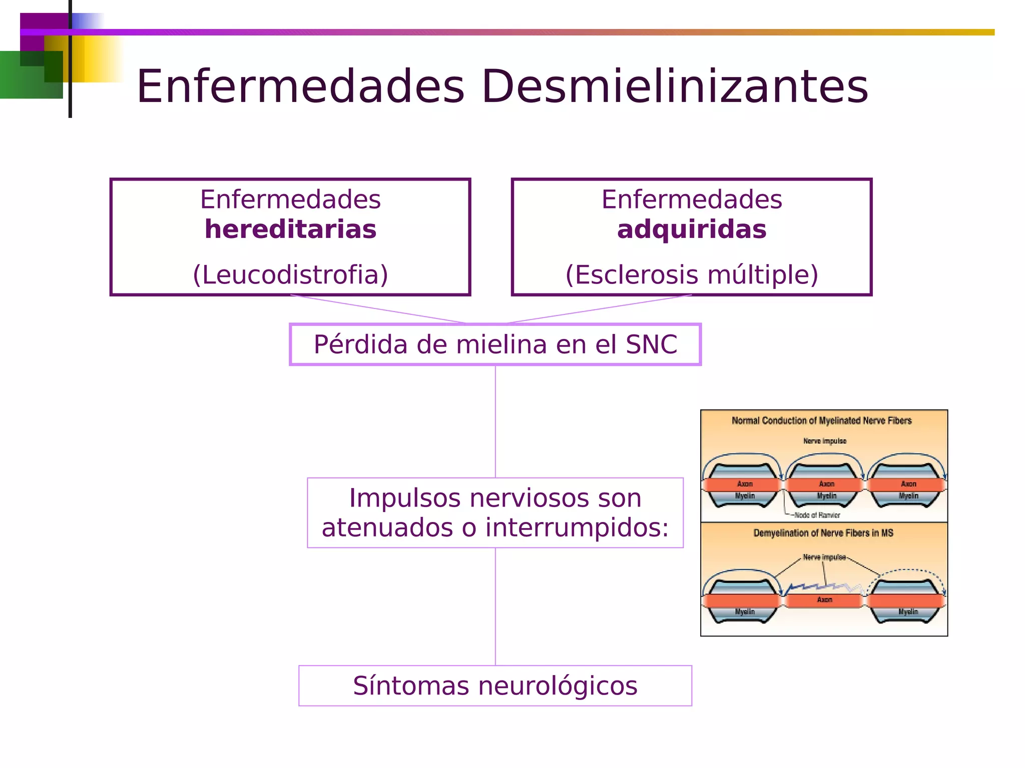Esclerosis Múltiple