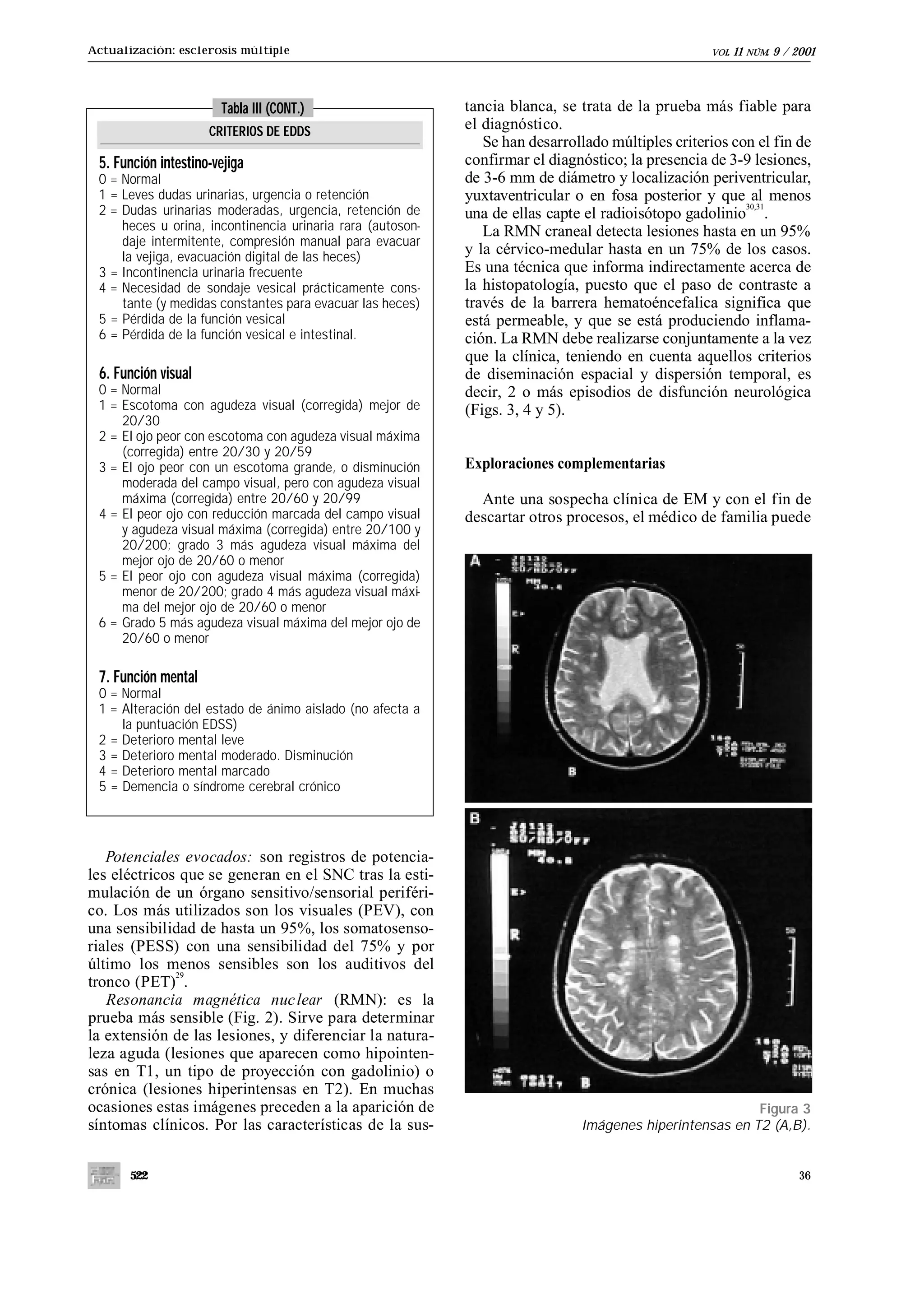 Actualización: esclerosis múltiple                                                                 VOL.   11   NÚM.   9 / 2001



                       Tabla III (CONT.)                    tancia blanca, se trata de la prueba más fiable para
                     CRITERIOS DE EDDS                      el diagnóstico.
                                                               Se han desarrollado múltiples criterios con el fin de
 5. Función intestino-vejiga                                confirmar el diagnóstico; la presencia de 3-9 lesiones,
 0 = Normal                                                 de 3-6 mm de diámetro y localización periventricular,
 1 = Leves dudas urinarias, urgencia o retención            yuxtaventricular o en fosa posterior y que al menos
                                                                                                         30,31
 2 = Dudas urinarias moderadas, urgencia, retención de      una de ellas capte el radioisótopo gadolinio .
     heces u orina, incontinencia urinaria rara (autoson-      La RMN craneal detecta lesiones hasta en un 95%
     daje intermitente, compresión manual para evacuar
     la vejiga, evacuación digital de las heces)
                                                            y la cérvico-medular hasta en un 75% de los casos.
 3 = Incontinencia urinaria frecuente                       Es una técnica que informa indirectamente acerca de
 4 = Necesidad de sondaje vesical prácticamente cons-       la histopatología, puesto que el paso de contraste a
     tante (y medidas constantes para evacuar las heces)    través de la barrera hematoéncefalica significa que
 5 = Pérdida de la función vesical                          está permeable, y que se está produciendo inflama-
 6 = Pérdida de la función vesical e intestinal.            ción. La RMN debe realizarse conjuntamente a la vez
                                                            que la clínica, teniendo en cuenta aquellos criterios
 6. Función visual                                          de diseminación espacial y dispersión temporal, es
 0 = Normal                                                 decir, 2 o más episodios de disfunción neurológica
 1 = Escotoma con agudeza visual (corregida) mejor de       (Figs. 3, 4 y 5).
     20/30
 2 = El ojo peor con escotoma con agudeza visual máxima
     (corregida) entre 20/30 y 20/59
 3 = El ojo peor con un escotoma grande, o disminución      Exploraciones complementarias
     moderada del campo visual, pero con agudeza visual
     máxima (corregida) entre 20/60 y 20/99                   Ante una sospecha clínica de EM y con el fin de
 4 = El peor ojo con reducción marcada del campo visual     descartar otros procesos, el médico de familia puede
     y agudeza visual máxima (corregida) entre 20/100 y
     20/200; grado 3 más agudeza visual máxima del
     mejor ojo de 20/60 o menor
 5 = El peor ojo con agudeza visual máxima (corregida)
     menor de 20/200; grado 4 más agudeza visual máxi-
     ma del mejor ojo de 20/60 o menor
 6 = Grado 5 más agudeza visual máxima del mejor ojo de
     20/60 o menor

 7. Función mental
 0 = Normal
 1 = Alteración del estado de ánimo aislado (no afecta a
     la puntuación EDSS)
 2 = Deterioro mental leve
 3 = Deterioro mental moderado. Disminución
 4 = Deterioro mental marcado
 5 = Demencia o síndrome cerebral crónico




   Potenciales evocados: son registros de potencia-
les eléctricos que se generan en el SNC tras la esti-
mulación de un órgano sensitivo/sensorial periféri-
co. Los más utilizados son los visuales (PEV), con
una sensibilidad de hasta un 95%, los somatosenso-
riales (PESS) con una sensibilidad del 75% y por
último los menos sensibles son los auditivos del
              29
tronco (PET) .
   Resonancia magnética nuc lear (RMN): es la
prueba más sensible (Fig. 2). Sirve para determinar
la extensión de las lesiones, y diferenciar la natura-
leza aguda (lesiones que aparecen como hipointen-
sas en T1, un tipo de proyección con gadolinio) o
crónica (lesiones hiperintensas en T2). En muchas
ocasiones estas imágenes preceden a la aparición de                                                      Figura 3
síntomas clínicos. Por las características de la sus-                         Imágenes hiperintensas en T2 (A,B).


       522                                                                                                                 36
 