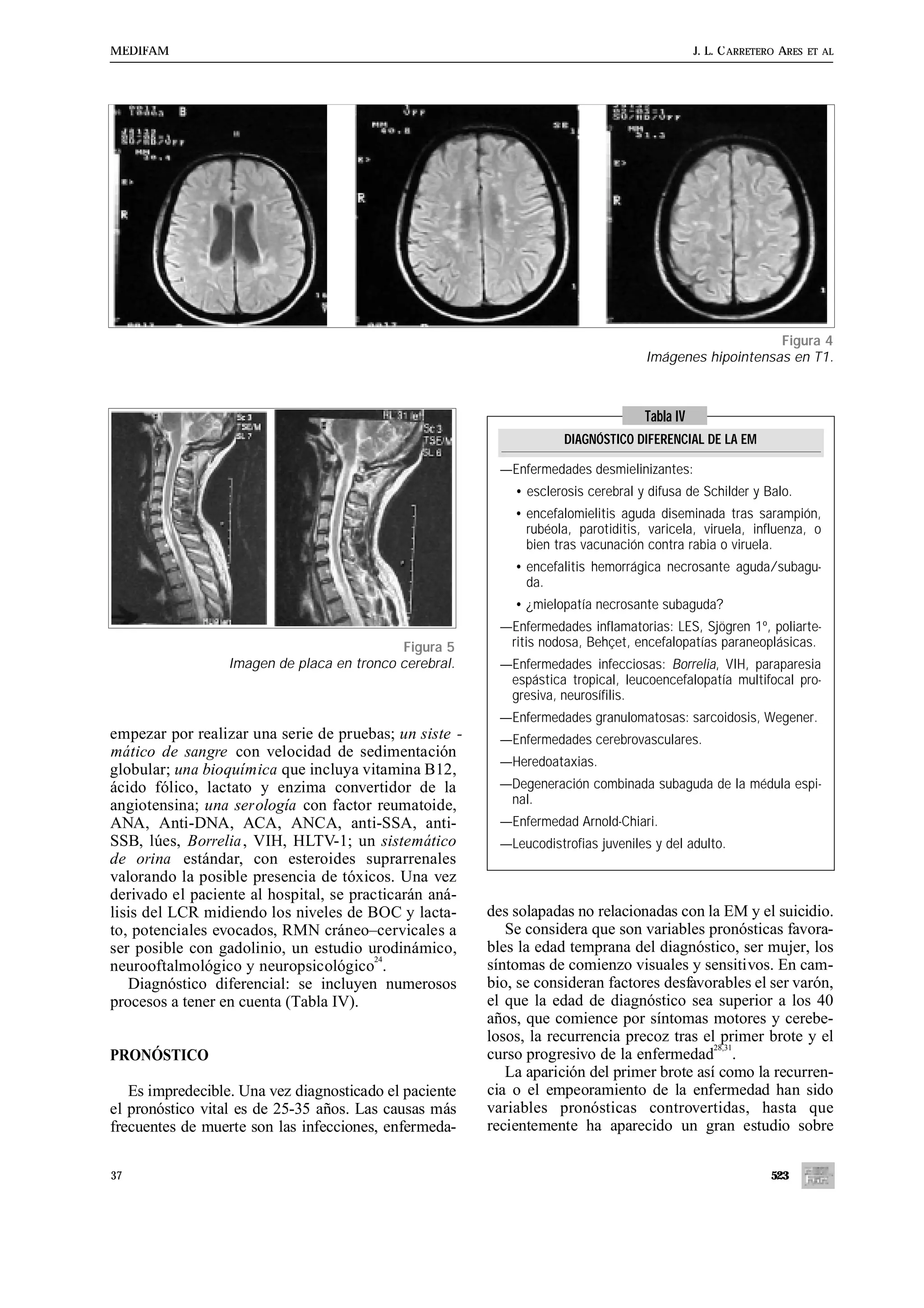 MEDIFAM                                                                                       J. L. C ARRETERO ARES   ET AL




                                                                                                       Figura 4
                                                                                   Imágenes hipointensas en T1.



                                                                                   Tabla IV
                                                                     DIAGNÓSTICO DIFERENCIAL DE LA EM

                                                          —Enfermedades desmielinizantes:
                                                            • esclerosis cerebral y difusa de Schilder y Balo.
                                                            • encefalomielitis aguda diseminada tras sarampión,
                                                              rubéola, parotiditis, varicela, viruela, influenza, o
                                                              bien tras vacunación contra rabia o viruela.
                                                            • encefalitis hemorrágica necrosante aguda/subagu-
                                                              da.
                                                            • ¿mielopatía necrosante subaguda?
                                                          —Enfermedades inflamatorias: LES, Sjögren 1º, poliarte-
                                            Figura 5       ritis nodosa, Behçet, encefalopatías paraneoplásicas.
                  Imagen de placa en tronco cerebral.     —Enfermedades infecciosas: Borrelia, VIH, paraparesia
                                                           espástica tropical, leucoencefalopatía multifocal pro-
                                                           gresiva, neurosífilis.
                                                          —Enfermedades granulomatosas: sarcoidosis, Wegener.
empezar por realizar una serie de pruebas; un siste -     —Enfermedades cerebrovasculares.
mático de sangre con velocidad de sedimentación
                                                          —Heredoataxias.
globular; una bioquímica que incluya vitamina B12,
ácido fólico, lactato y enzima convertidor de la          —Degeneración combinada subaguda de la médula espi-
angiotensina; una serología con factor reumatoide,         nal.
ANA, Anti-DNA, ACA, ANCA, anti-SSA, anti-                 —Enfermedad Arnold-Chiari.
SSB, lúes, Borrelia , VIH, HLTV-1; un sistemático         —Leucodistrofias juveniles y del adulto.
de orina estándar, con esteroides suprarrenales
valorando la posible presencia de tóxicos. Una vez
derivado el paciente al hospital, se practicarán aná-
lisis del LCR midiendo los niveles de BOC y lacta-      des solapadas no relacionadas con la EM y el suicidio.
to, potenciales evocados, RMN cráneo–cervicales a          Se considera que son variables pronósticas favora-
ser posible con gadolinio, un estudio urodinámico,      bles la edad temprana del diagnóstico, ser mujer, los
                                         24
neurooftalmológico y neuropsicológico .                 síntomas de comienzo visuales y sensitivos. En cam-
   Diagnóstico diferencial: se incluyen numerosos       bio, se consideran factores desfavorables el ser varón,
procesos a tener en cuenta (Tabla IV).                  el que la edad de diagnóstico sea superior a los 40
                                                        años, que comience por síntomas motores y cerebe-
                                                        losos, la recurrencia precoz tras el primer brote y el
                                                                                            28,31
PRONÓSTICO                                              curso progresivo de la enfermedad .
                                                           La aparición del primer brote así como la recurren-
   Es impredecible. Una vez diagnosticado el paciente   cia o el empeoramiento de la enfermedad han sido
el pronóstico vital es de 25-35 años. Las causas más    variables pronósticas controvertidas, hasta que
frecuentes de muerte son las infecciones, enfermeda-    recientemente ha aparecido un gran estudio sobre


37                                                                                                          523
 