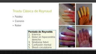 Triada Clásica de Raynaud
 Palidez
 Cianosis
 Rubor
Pentada de Reynolds
1. Ictericia
2. Dolor en hipocondrio
derecho
3. Síndrome febril
4. Confusión mental
5. Shock circulatorio
 