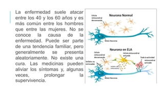 La enfermedad suele atacar
entre los 40 y los 60 años y es
más común entre los hombres
que entre las mujeres. No se
conoce la causa de la
enfermedad. Puede ser parte
de una tendencia familiar, pero
generalmente se presenta
aleatoriamente. No existe una
cura. Las medicinas pueden
aliviar los síntomas y, algunas
veces, prolongar la
supervivencia.
 