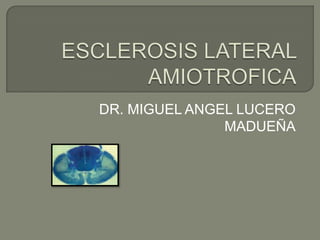 ESCLEROSIS LATERAL AMIOTROFICA,[object Object],DR. MIGUEL ANGEL LUCERO MADUEÑA,[object Object]
