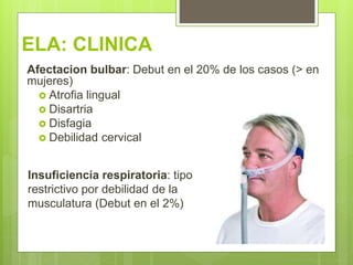 ELA: CLINICA
Afectacion bulbar: Debut en el 20% de los casos (> en
mujeres)
 Atrofia lingual
 Disartria
 Disfagia
 Debilidad cervical
Insuficiencia respiratoria: tipo
restrictivo por debilidad de la
musculatura (Debut en el 2%)
 