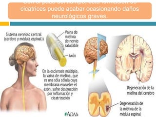 Con el paso del tiempo, esta formación de
cicatrices puede acabar ocasionando daños
neurológicos graves.
 