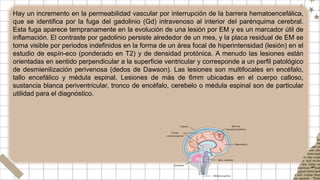 Hay un incremento en la permeabilidad vascular por interrupción de la barrera hematoencefálica,
que se identifica por la fuga del gadolinio (Gd) intravenoso al interior del parénquima cerebral.
Esta fuga aparece tempranamente en la evolución de una lesión por EM y es un marcador útil de
inflamación. El contraste por gadolinio persiste alrededor de un mes, y la placa residual de EM se
torna visible por periodos indefinidos en la forma de un área focal de hiperintensidad (lesión) en el
estudio de espín-eco (ponderado en T2) y de densidad protónica. A menudo las lesiones están
orientadas en sentido perpendicular a la superficie ventricular y corresponde a un perfil patológico
de desmienilización perivenosa (dedos de Dawson). Las lesiones son multifocales en encéfalo,
tallo encefálico y médula espinal. Lesiones de más de 6mm ubicadas en el cuerpo calloso,
sustancia blanca periventricular, tronco de encéfalo, cerebelo o médula espinal son de particular
utilidad para el diagnóstico.
 