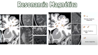 Resonancia Magnética
 