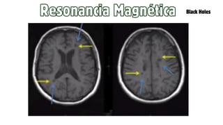 Resonancia Magnética Black Holes
 
