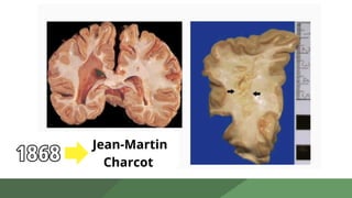 1868
Jean-Martin
Charcot
 