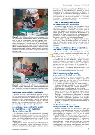 Esclerosis múltiple y kinesiterapia ¶ E – 26-431-A-20

trastornos circulatorios (edema), etc. En la medida en
que persista la «espina irritativa», también lo hará la
tendencia de los miembros inferiores a la flexión y la
inhibición de la transmisión nerviosa en extensión. La
rehabilitación apunta entonces a reducir los estímulos
nociceptivos de flexión (tratamiento de las espinas
irritativas) y a fortalecer los extensores de los miembros
inferiores (estímulos de extensión).

Técnicas pasivas para disminuir
la espasticidad en triple ﬂexión
Crioterapia ante la espasticidad en flexión: en los
casos más favorables, la crioterapia disminuye la espasticidad de los flexores y suministra una energía extra, de
modo que el paciente ya no siente cansancio. En otros
casos, reduce de forma considerable la espasticidad en
extensión. Si el paciente utiliza esta espasticidad para
ponerse de pie y caminar, sería mejor no poner la
crioterapia antes de los ejercicios funcionales.
En caso de necesidad, se implementan medidas
destinadas a tratar las espinas irritativas. Por ejemplo, en
caso de edema: presoterapia, también con postura en
extensión, elevación de los pies de la cama, drenaje
linfático, etc.

Figura 7. Hacen falta varias facilitaciones para alcanzar y reforzar la ﬂexión del miembro inferior derecho: el decúbito disminuye el tono de los extensores, un cojín levanta la pelvis y
acentúa la ﬂexión lumbar (lo que facilita la triple ﬂexión gracias al
reﬂejo tónico lumbar) y un cojín debajo de la cabeza inhibe el
opistótonos. El rehabilitador coloca el miembro contralateral en
ﬂexión. El paciente empuja hacia la izquierda y ﬂexiona el miembro derecho. Utiliza el «reﬂejo de ﬂexión cruzado». El mantenimiento de la posición se cronometra. Progresión: se disminuyen
las facilitaciones.

Técnicas funcionales activas que permiten
fortalecer la triple extensión
.2

El ejercicio posición sentada-bipedestación-posición
sentada permite fortalecer considerablemente los estímulos de extensión, siempre que el paciente sea capaz
de hacerlo (Fig. 9).
Si es posible, aumentar el perímetro de marcha (si es
necesario con andador, bastones o barras paralelas)
permite fortalecer los impulsos hacia los músculos
extensores y combatir el edema por su acción sobre la
circulación. En los ejercicios de deambulación, el
kinesiterapeuta suele advertir que el déficit motor no
sólo afecta a los extensores y la triple extensión, sino
también a la triple flexión. En este sentido, la fase de
oscilación de la marcha también es dificultosa.

Ejercicios activos no funcionales
para fortalecer la triple extensión

Figura 8. Fortalecimiento de la ﬂexión del miembro inferior
izquierdo, que está menos afectado. El kinesiterapeuta no sostiene el miembro contralateral, simplemente estabiliza el cojín.

Mejoría de las actividades funcionales
Permite verificar la eficacia de las distintas técnicas.
En los pacientes que tienen una lesión de gravedad
intermedia, el aumento del perímetro de marcha es un
criterio objetivo (cuantificado) y simple que permite
controlar la eficacia de las técnicas dirigidas a tratar la
espasticidad. No resulta convincente mejorar la calidad
de la marcha sin que aumente el perímetro.

Espasticidad predominante sobre
la triple ﬂexión, con debilidad
de la triple extensión
La transmisión nerviosa de extensión (que favorece la
triple extensión) ya no es suficiente para que el paciente
se levante de la silla de ruedas o para las transferencias
desde ésta a la cama. La transmisión nerviosa de flexión
(que favorece la triple flexión) es más fuerte y domina
la motricidad.
Ejemplos de espinas irritativas que inducen flexión:
herida, uña encarnada, escara, intervención quirúrgica
reciente, infección urinaria, esguince, artrosis, ciática,
Kinesiterapia - Medicina física

Estos ejercicios deben usarse con prudencia porque
producen cansancio. Se corre el riesgo de agotar las
últimas fuerzas del paciente, hasta el punto de que le
sea imposible caminar a continuación.
• El pedaleo contra resistencia con un artromotor es
muy apreciado por los pacientes que han perdido la
capacidad de caminar o que caminan muy poco.
• Fortalecimiento sobre la mesa de kinesiterapia.
• Verticalización en plano inclinado (o en un verticalizador). Se colocan los pies en ligera flexión plantar
para facilitar la extensión. El plano está levemente
inclinado y las rodillas algo flexionadas. Se indica al
paciente que empuje en extensión con la cabeza y
que extienda los miembros inferiores. Así se utiliza el
opistótonos como facilitación (extensión global del
cuerpo). En progresión, se aumenta la inclinación de
la mesa.

Tratamiento médico en caso
de espasticidad en triple ﬂexión
Para los pacientes con una discapacidad grave que
siguen un esquema de triple retirada, el tratamiento
farmacológico de la espasticidad mejora la comodidad y
la posición del paciente en la cama o la silla de ruedas,
lo cual facilita la movilización pasiva y las posturas.
En los pacientes que sólo presentan debilidad de los
músculos extensores (antigravitatorios), el tratamiento
médico de la espasticidad puede disminuir la fuerza de
estos músculos y agravar la dependencia (las transferencias de la cama a la silla de ruedas son más difíciles). El
kinesiterapeuta debe señalar al médico estas dificultades,
con el fin de que interrumpa el tratamiento.

7

 