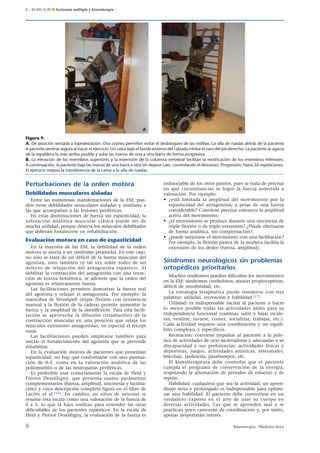 E – 26-431-A-20 ¶ Esclerosis múltiple y kinesiterapia

Figura 9.
A. De posición sentada a bipedestación. Dos cojines permiten evitar el desbloqueo de las rodillas. La silla de ruedas detrás de la paciente
le permite sentirse segura al hacer el ejercicio. Un calce bajo el borde externo del calzado inhibe el varo del pie derecho. La paciente se agarra
de la espaldera lo más arriba posible y sube las manos de una a otra barra de forma progresiva.
B. La elevación de los miembros superiores y la extensión de la columna vertebral facilitan la rectiﬁcación de los miembros inferiores.
A continuación, la paciente baja las manos de una barra a otra sin dejarse caer, controlando el descenso. Progresión: hasta 50 repeticiones.
El ejercicio mejora la transferencia de la cama a la silla de ruedas.

Perturbaciones de la orden motora
Debilidades musculares aisladas
Entre las numerosas manifestaciones de la EM, pueden verse debilidades musculares aisladas y similares a
las que acompañan a las lesiones periféricas.
En estas disminuciones de fuerza sin espasticidad, la
valoración analítica muscular clásica puede ser de
mucha utilidad, porque detecta los músculos debilitados
que deberán fortalecerse en rehabilitación.

Evaluación motora en caso de espasticidad
En la mayoría de las EM, la debilidad de la orden
motora se asocia a un síndrome piramidal. En este caso,
no sólo se trata de un déficit de la fuerza muscular del
agonista, sino también (y tal vez sobre todo) de un
defecto de relajación del antagonista espástico. Al
debilitar la contracción del antagonista con una inyección de toxina botulínica, se advierte que la orden del
agonista es relativamente buena.
Las facilitaciones permiten demostrar la fuerza real
del agonista y relajan el antagonista. Por ejemplo: la
maniobra de Strumpell (triple flexión con resistencia
manual a la flexión de la cadera) permite aumentar la
fuerza y la amplitud de la dorsiflexión. Para esta facilitación se aprovecha la difusión (irradiación) de la
contracción muscular en una posición que relaja los
músculos extensores antagonistas, en especial el tríceps
sural.
Las facilitaciones pueden emplearse también para
iniciar el fortalecimiento del agonista que se pretende
rehabilitar.
En la evaluación motora de pacientes que presentan
espasticidad, no hay que conformarse con una puntuación de 0-5, como en la valoración analítica de las
poliomielitis o de las neuropatías periféricas.
Es preferible usar correctamente la escala de Held y
Pierrot Deseilligny, que presenta cuatro parámetros
complementarios (fuerza, amplitud, sincinesia y facilitación) y cuya descripción completa figura en el libro de
Lacôte et al [16]. En cambio, en sitios de internet se
resume esta escala como una valoración de la fuerza de
0 a 5, lo que la hace ineficaz para entender las otras
dificultades de los pacientes espásticos. En la escala de
Held y Pierrot Deseilligny, la evaluación de la fuerza es

8

indisociable de los otros puntos, pues se trata de precisar
en qué circunstancias se logró la fuerza sometida a
valoración. Por ejemplo:
• ¿está limitada la amplitud del movimiento por la
espasticidad del antagonista, a pesar de una fuerza
considerable? Conviene precisar entonces la amplitud
activa del movimiento;
• ¿el movimiento se produce durante una sincinesia de
triple flexión o de triple extensión? ¿Puede efectuarse
de forma analítica, sin compensación?;
• ¿puede mejorarse el movimiento con una facilitación?
Por ejemplo, la flexión pasiva de la muñeca facilita la
extensión de los dedos (fuerza, amplitud).

Síndromes neurológicos sin problemas
ortopédicos prioritarios
Muchos síndromes pueden dificultar los movimientos
en la EM: síndromes cerebelosos, ataxias propioceptivas,
déficit de sensibilidad, etc.
La estrategia terapéutica puede resumirse con tres
palabras: utilidad, recreación y habilidad [17].
Utilidad: es indispensable incitar al paciente a hacer
lo mejor posible todas las actividades útiles para su
independencia funcional (caminar, subir y bajar escaleras, vestirse, lavarse, comer, socializar, trabajar, etc.).
Cada actividad requiere una coordinación y un equilibrio complejos y específicos.
Recreación: conviene impulsar al paciente a la práctica de actividades de ocio motivadoras y adecuadas a su
discapacidad y sus preferencias: actividades físicas y
deportivas, juegos, actividades artísticas, artesanales,
bricolaje, jardinería, pasatiempos, etc.
El kinesiterapeuta debe controlar que el paciente
cumpla el programa de conservación de la energía,
respetando la alternación de períodos de esfuerzo y de
reposo.
Habilidad: cualquiera que sea la actividad, un aprendizaje serio y prolongado es indispensable para optimizar una habilidad. El paciente debe convertirse en un
verdadero experto en el arte de usar su cuerpo en
diversas actividades. Las que se aprenden mal y se
practican poco carecerán de coordinación y, por tanto,
apenas despertarán interés.
Kinesiterapia - Medicina física

 